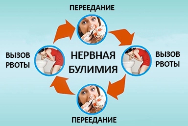 Лечение булимии в Линёво